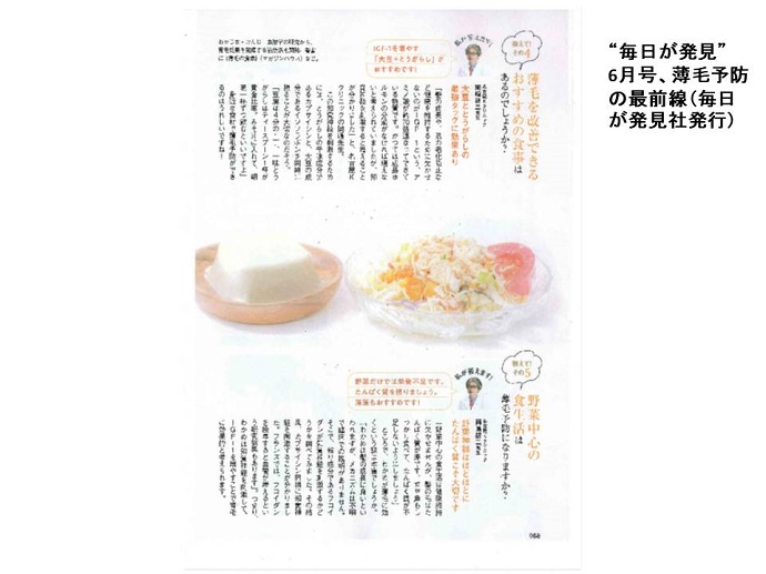 円形脱毛症　病院""